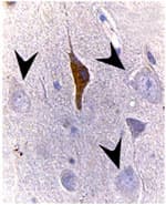 BAX Antibody