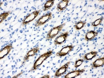 Polyclonal Rabbit anti-Human AQP2 / Aquaporin 2 Antibody (IHC, WB)