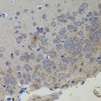 Vimentin Antibody