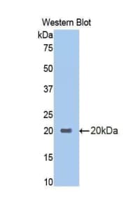 CRH / CRF Antibody (aa39-187)