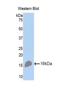 TNFRSF17 / BCMA Antibody (aa71-184, Biotin)