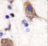 SCYL2 Antibody (aa643-672)