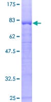 Human PPP2R2B Protein (Recombinant GST)