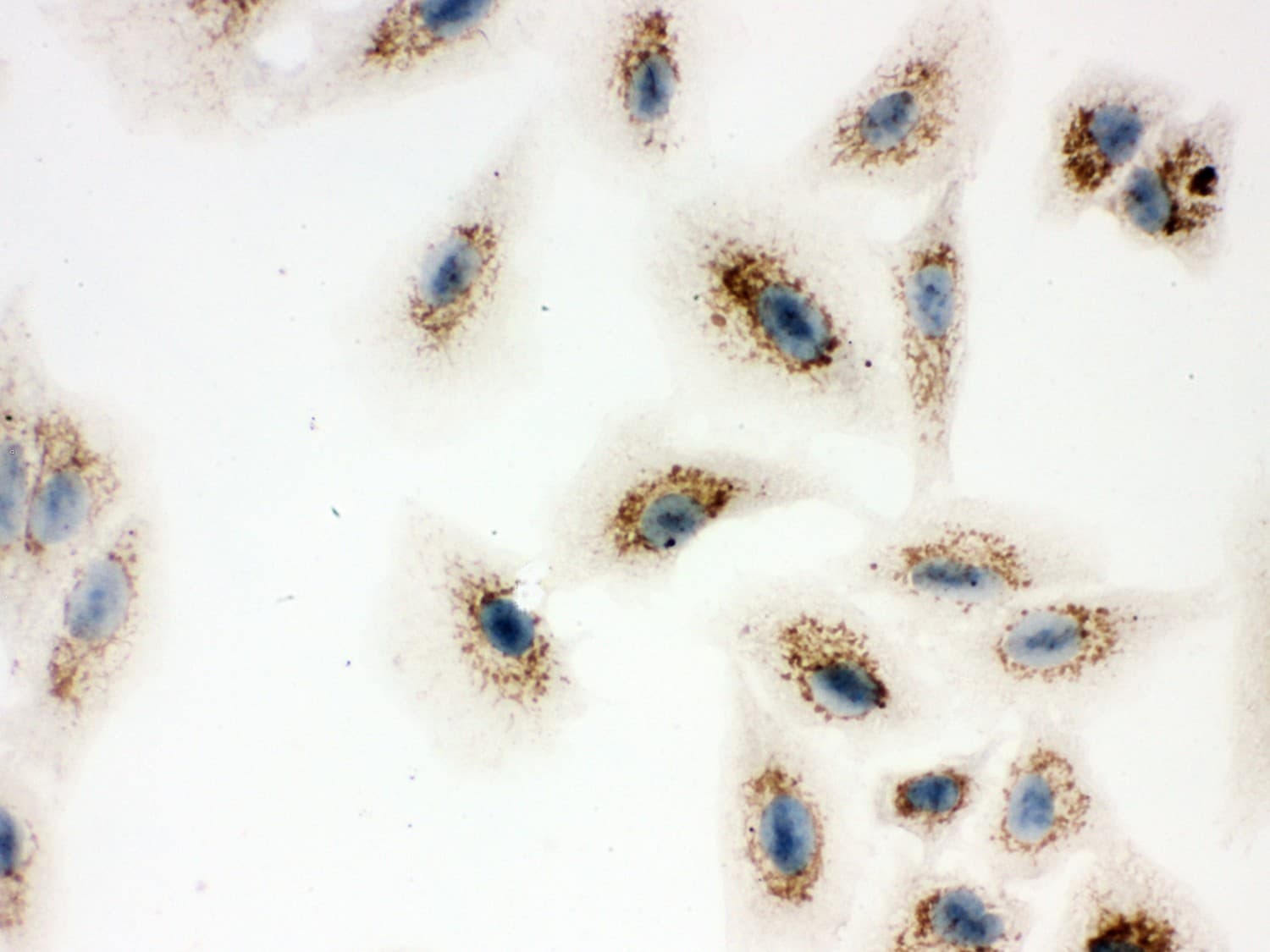 ATP5H Antibody (aa2-161)