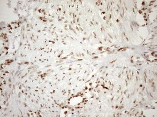 MGMT Antibody (clone OTI4F9)