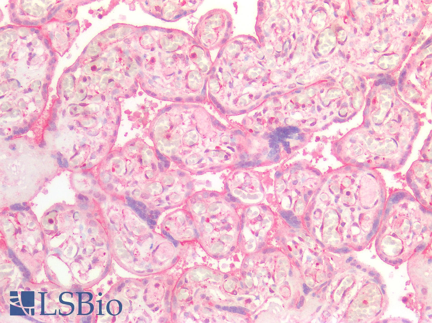 PathPlus™ Polyclonal Rabbit anti-Human INSR / Insulin Receptor Antibody (Internal, IHC)