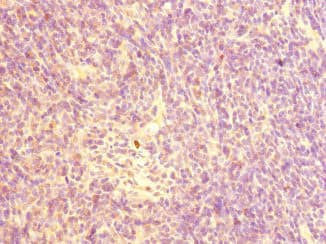 Polyclonal Rabbit anti-Human CHRNA10 Antibody (IHC, WB)