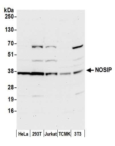 Polyclonal Rabbit anti-Human NOSIP Antibody (aa251-301, WB)