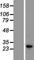 KCNIP4 / KCHIP4 Protein (Over-Expression Lysate Myc-DDK (Flag))