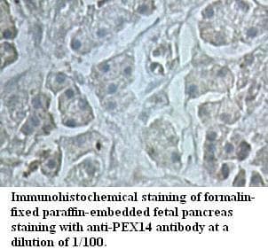 PEX14 Antibody (aa67-338)