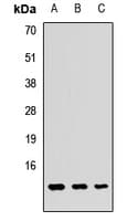 IHC-plus™ Polyclonal Rabbit anti-Human GUCA2A / Guanylin Antibody (IHC, WB)