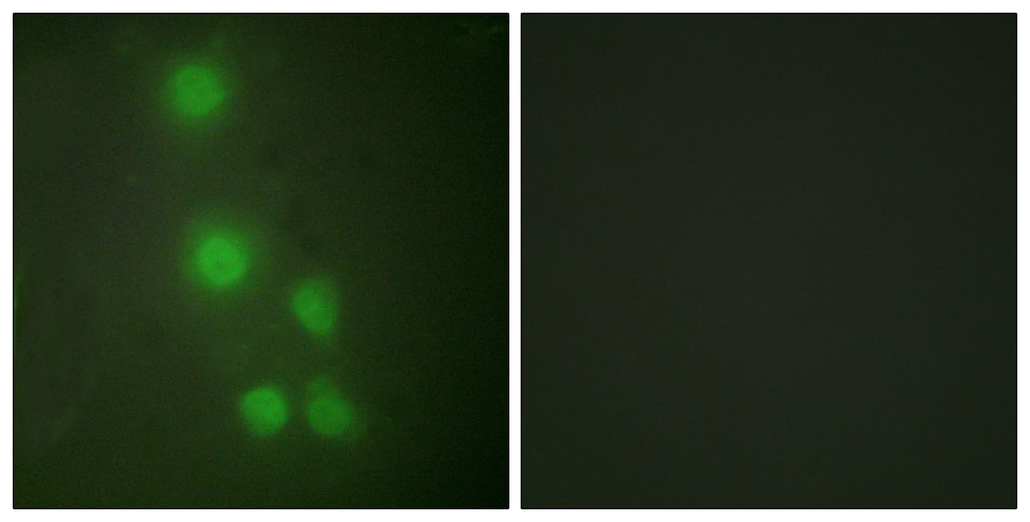 IHC-plus™ BAF53 / ACTL6A Antibody (aa201-250)