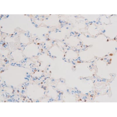 PRKCQ / PKC-Theta Antibody (phospho-Ser676)