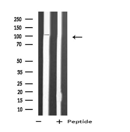 MPRIP / RIP3 Antibody