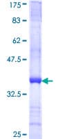 Human TM9SF2 Protein (Recombinant GST, N-terminus)