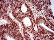 NBN / Nibrin Antibody (aa400-650, clone 7E4A2)