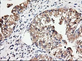 Monoclonal Mouse anti-Human TUBB4 / Tubulin Beta 4 Antibody (clone OTI5C1, IHC, IF, WB)