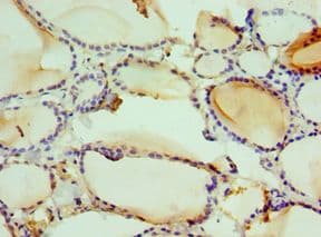 HMGN2 Antibody (aa1-90)