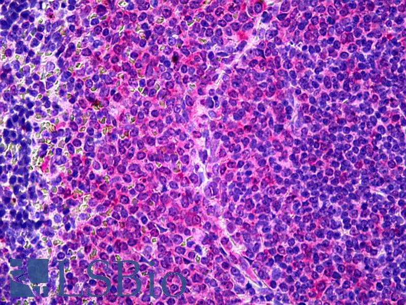 PathPlus™ IL6 / Interleukin 6 Antibody (clone 10E5)