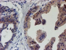 EIF4E2 / IF4e Antibody (clone OTI4E7)