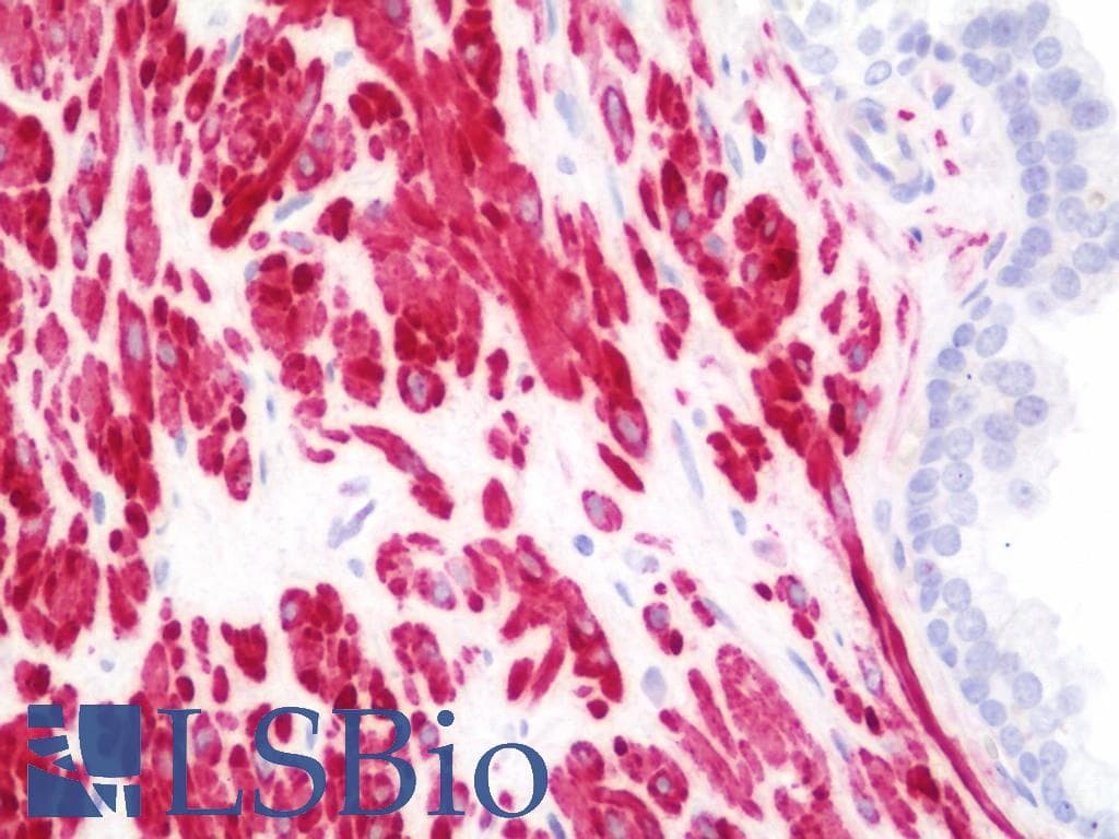 PathPlus™ ACTG2 Antibody (aa343-371)