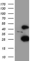 CENPH / CENP-H Antibody (clone OTI2A11)