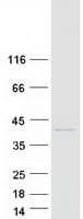 Human VAP33 / VAPA Protein (Recombinant Myc-DDK (Flag))