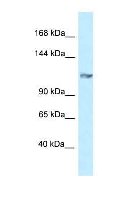 Polyclonal Rabbit anti-Mouse GRIK5 / KA2 Antibody (aa244-293, WB)