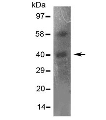 CCR5 Antibody (aa19-34)