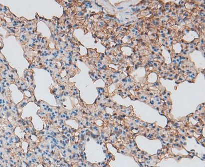 GPC3 / Glypican 3 Antibody