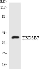 PathPlus™ Polyclonal Rabbit anti-Human HSD3B7 Antibody (aa108-157, IHC, WB)