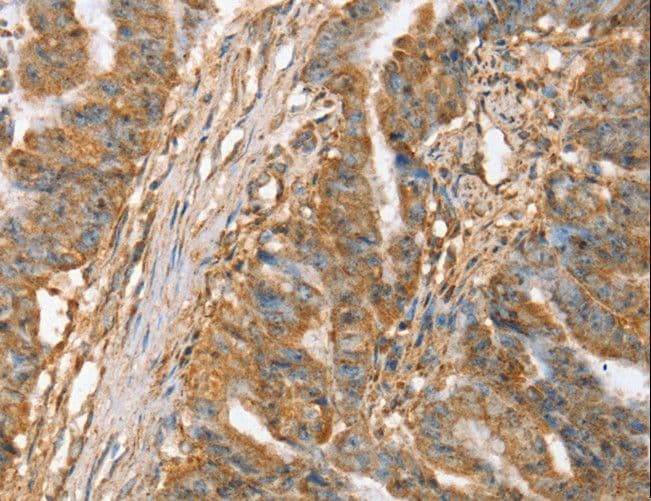 SLC41A2 Antibody