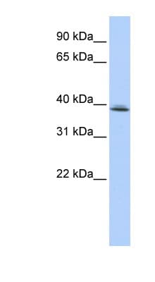 SRRD Antibody (C-Terminus)