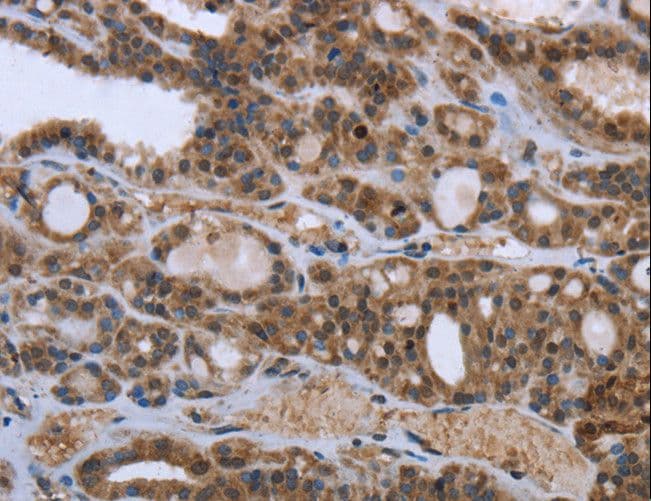 Polyclonal Rabbit anti-Human GGCX Antibody (IHC, WB)