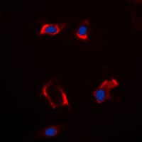 CYP2S1 Antibody (Internal)