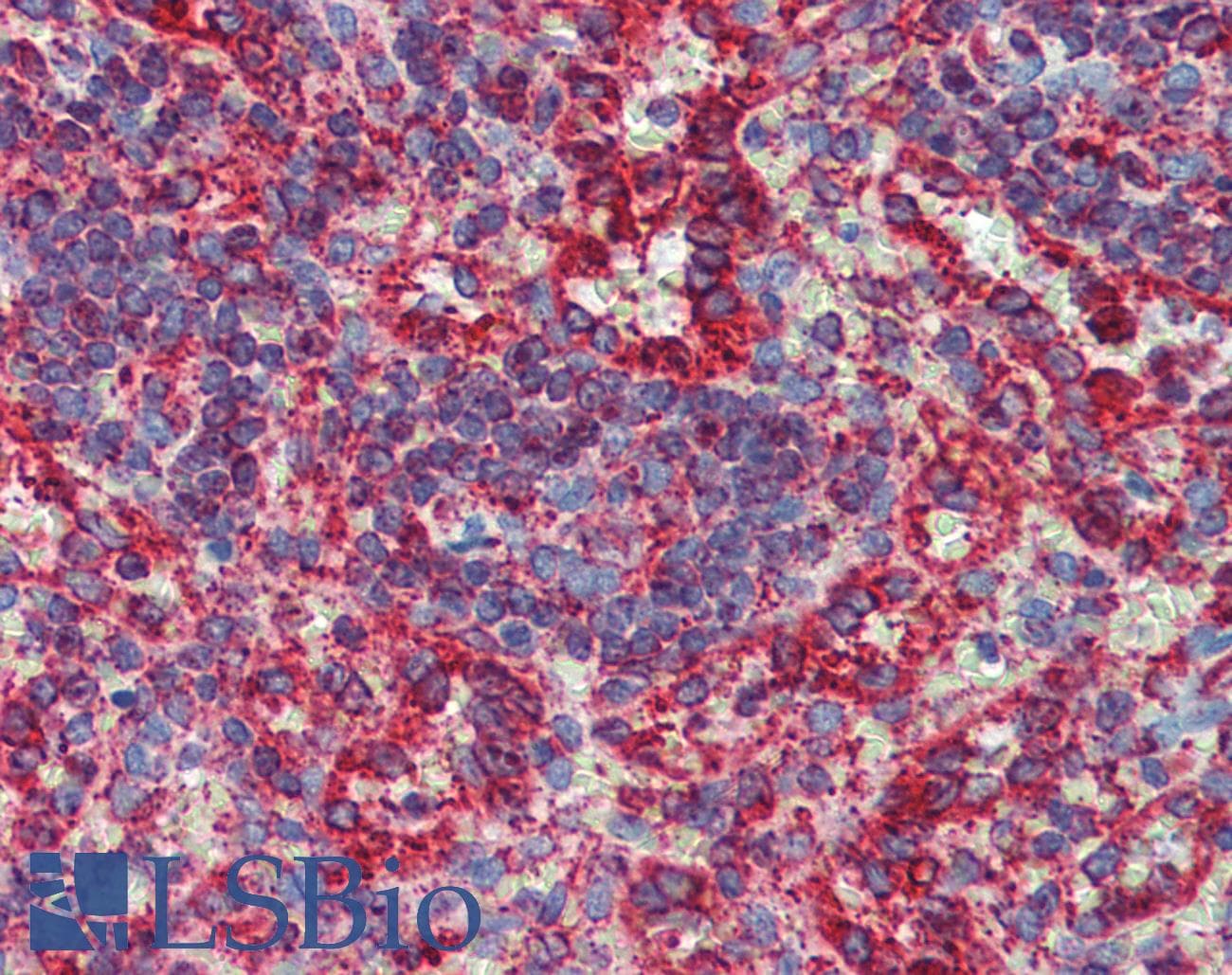 Polyclonal Rabbit anti-Human P450SCC / CYP11A1 Antibody (aa288-337, IHC, WB)