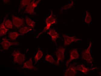 PSMD2 Antibody