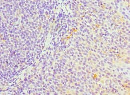 Polyclonal Rabbit anti-Human SERPINH1 / HSP47 Antibody (aa139-418, IHC, WB)
