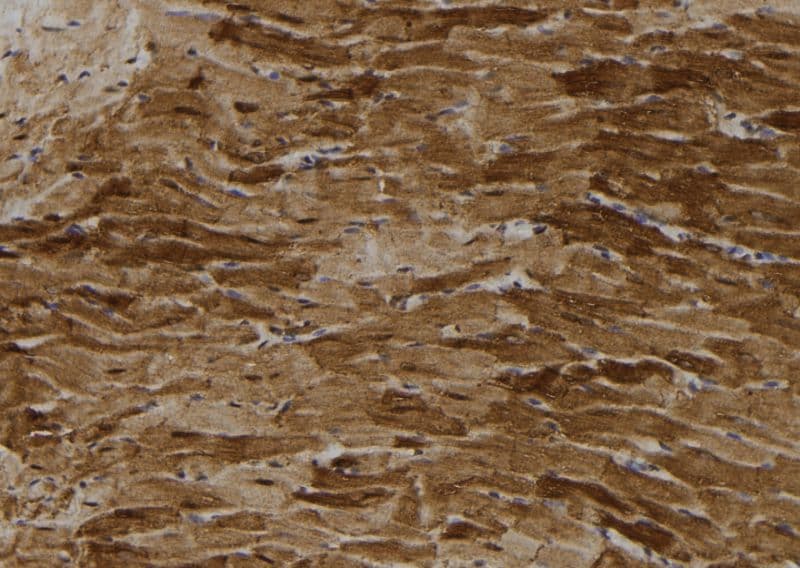 PFK2 / PFKFB3 Antibody