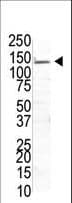 USP8 / UBPY Antibody (aa1-30)