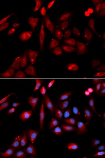 Polyclonal Rabbit anti-Human RANGAP1 Antibody (IHC, IF, WB)