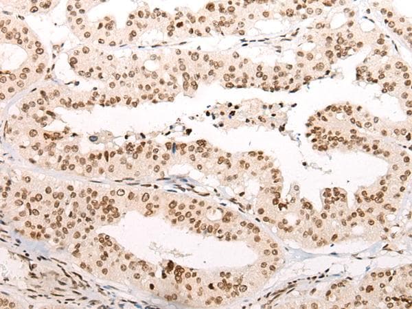 Polyclonal Rabbit anti-Human C11orf2 / Fat-Free Antibody (IHC)