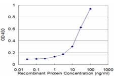 RBP3 / IRBP Antibody (clone 4F3)