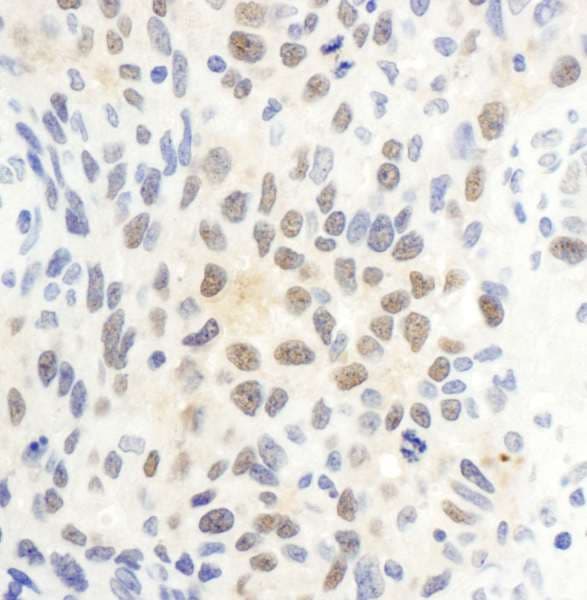 Polyclonal Rabbit anti-Human CTR9 Antibody (aa1123-1173, IHC, WB)