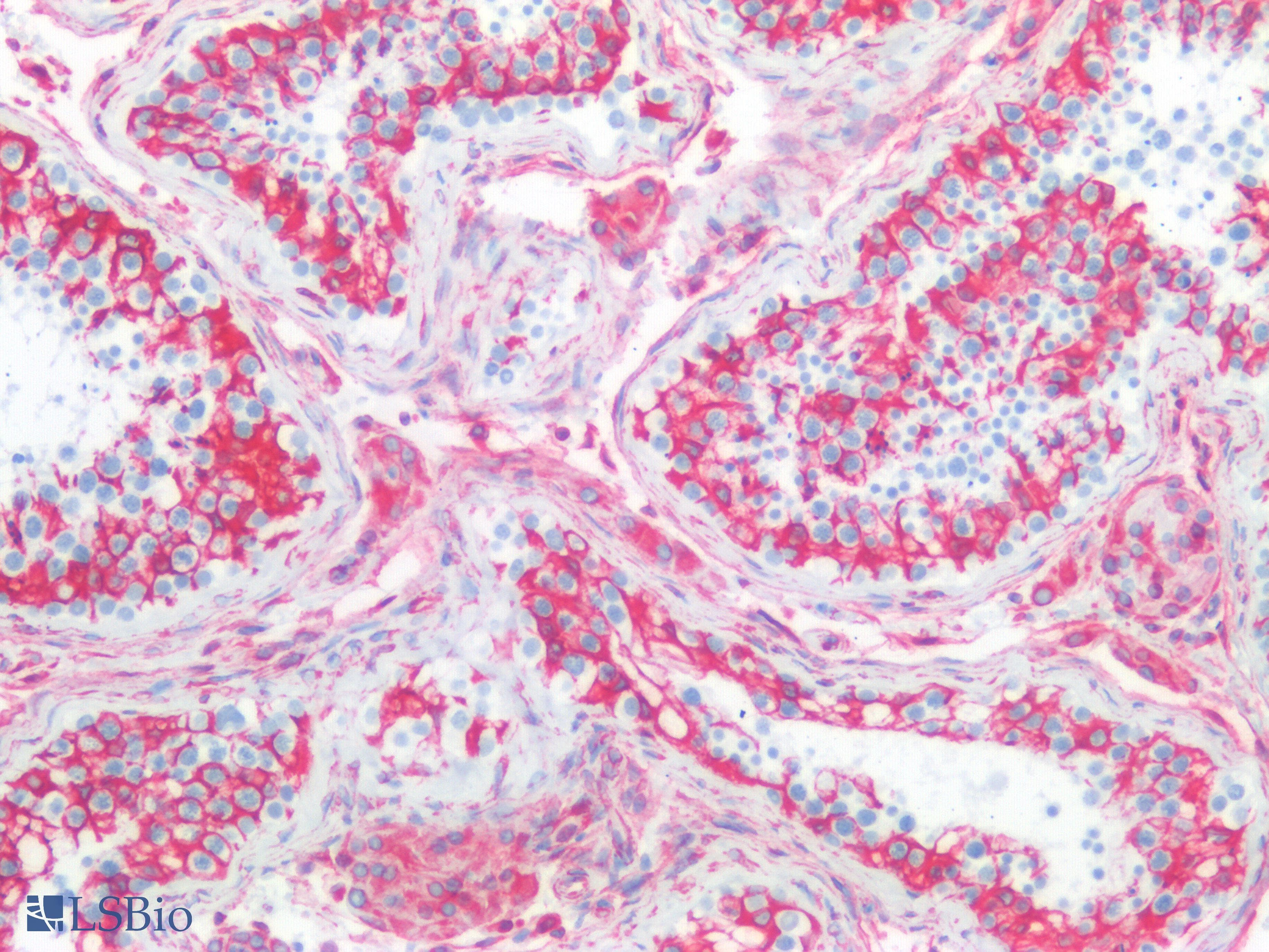 PathPlus™ Polyclonal Rabbit anti-Human Vimentin Antibody (IHC)