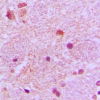 SIP / TP53INP1 Antibody (C-Terminus)