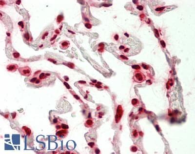 IHC-plus™ HNRNPA2B1 Antibody