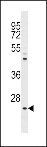 NEUROG1 / NGN1 / Neurogenin 1 Antibody (aa31-60)