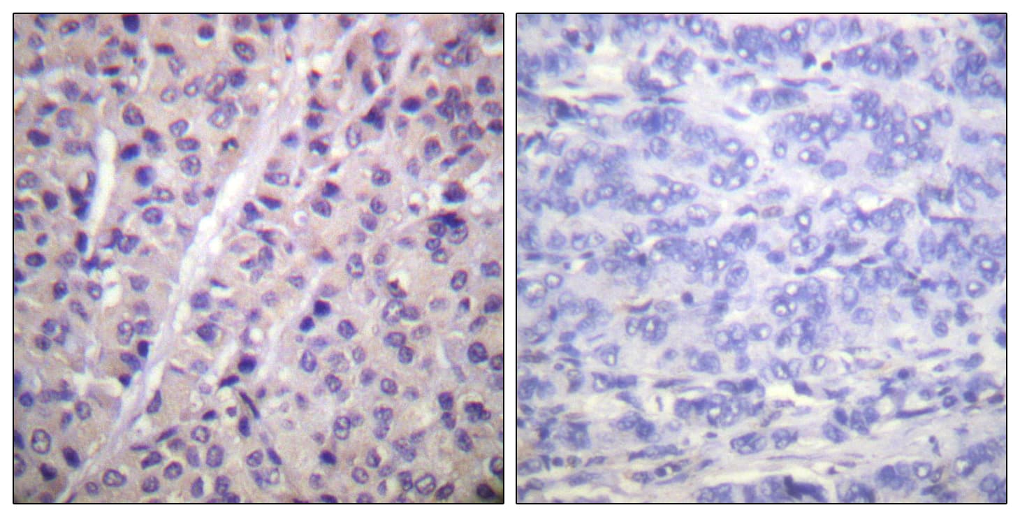 ARAF / ARAF1 / A-RAF Antibody (phospho-Tyr302)