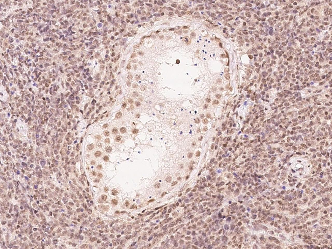 FBXO7 Antibody